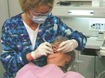 woman get a teeth cleaning